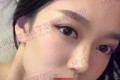 四川美萊醫(yī)學(xué)美容醫(yī)院做雙眼皮哪個(gè)醫(yī)生比較好