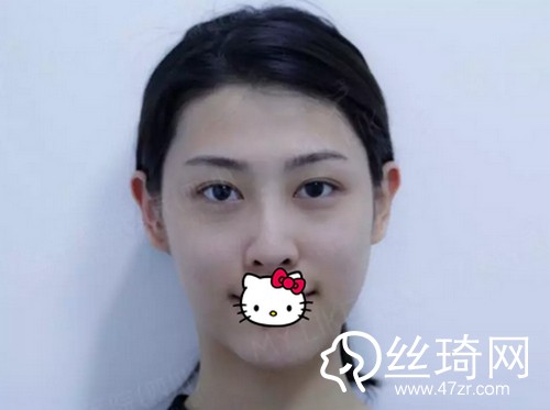 四川美萊醫(yī)學美容醫(yī)院熊猛怎么樣