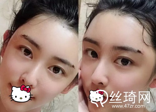 四川美萊醫(yī)學美容醫(yī)院熊猛怎么樣