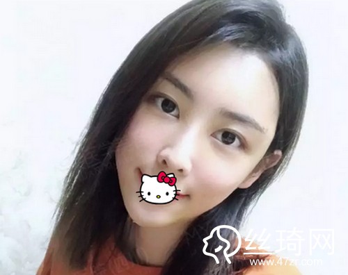 四川美萊醫(yī)學美容醫(yī)院熊猛怎么樣