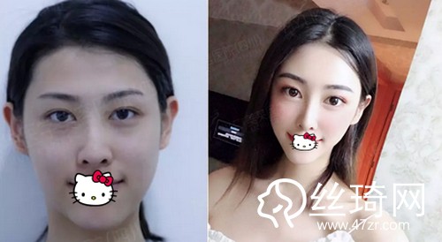 四川美萊醫(yī)學美容醫(yī)院熊猛怎么樣