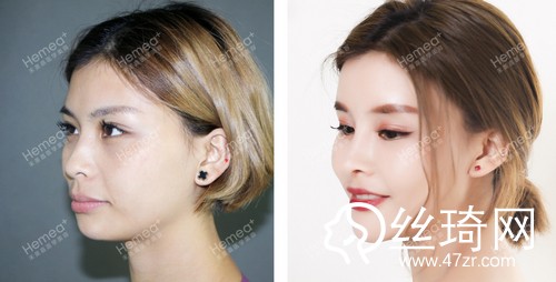 北京禾美嘉醫(yī)療美容怎么樣內(nèi)附2019全新價格表