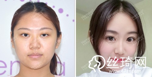 北京禾美嘉醫(yī)療美容怎么樣內(nèi)附2019全新價格表