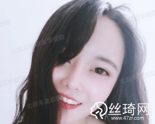 北京禾美嘉醫(yī)療美容自體脂肪填充面部那個(gè)醫(yī)生好？