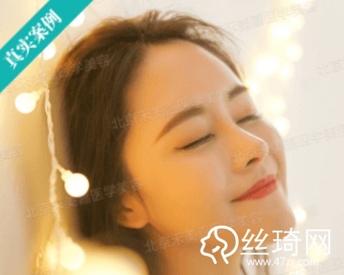 北京禾美嘉醫(yī)療美容自體脂肪填充面部那個(gè)醫(yī)生好？