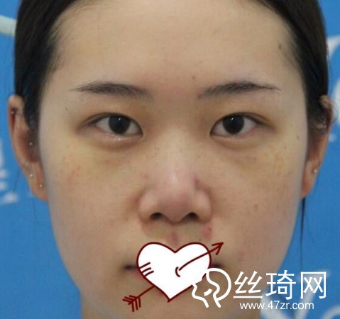 成都恒博醫(yī)院李烈醫(yī)生怎么樣？