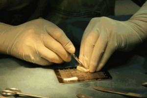 玻尿酸隆鼻也有被嫌棄的時(shí)候，你該怎么選?