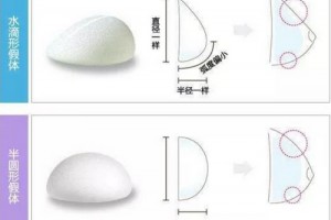 隆胸假體那么多，我們應(yīng)該如何選擇呢?