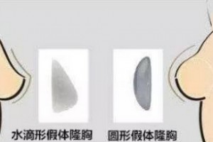 關(guān)于隆胸你較關(guān)心的幾個(gè)問題