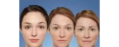 面部年輕化，多方面進(jìn)入時(shí)代