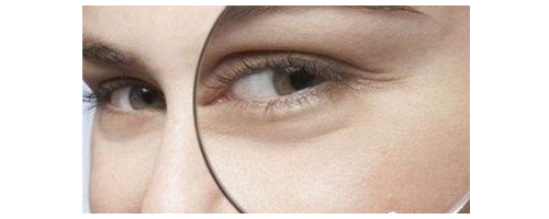 去魚尾紋要多少錢，去魚尾紋價(jià)格貴不貴