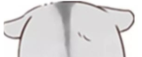 顴骨寬大，選擇顴弓內(nèi)推還是脂肪填充？哪個能讓臉變小