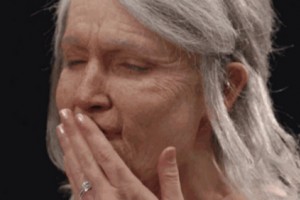 ?抗衰還得靠注射除皺!皺紋形成原因？