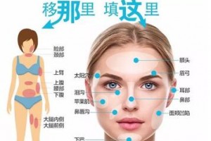 自體脂肪填充，將脂肪變廢為寶！自體脂肪的成活率高嗎