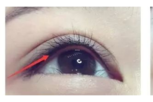 做美瞳線，疼不疼？半永.久美瞳線優(yōu)勢(shì)有哪些