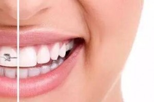 30歲后做牙齒矯正來得及嗎？做正畸會有什么危害？