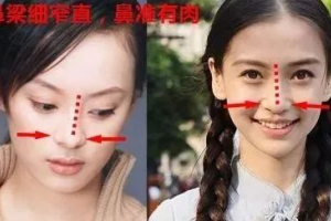 豐厚大鼻子、多肉細(xì)窄鼻子、獅子鼻、希臘鼻各是什么意思
