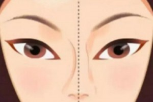 河北醫(yī)科大學(xué)第二醫(yī)院整形外科趙雪蓮怎么樣