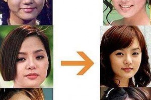 南寧美麗焦點整形醫(yī)院全新價格表