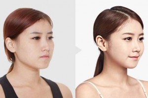 南寧韓成整形醫(yī)院全新價格表