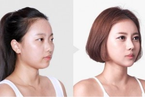 南京安安醫(yī)療整形美容醫(yī)院價格表