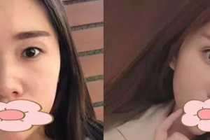 南寧邢文明整形醫(yī)院整形美容價格貴不貴