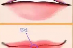 迷死人的微笑唇究竟是怎么做的？玻尿酸豐唇果好不好