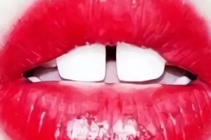 門牙縫大“漏財(cái)”還毀顏值，整形牙科醫(yī)教你2招關(guān)縫納財(cái)！