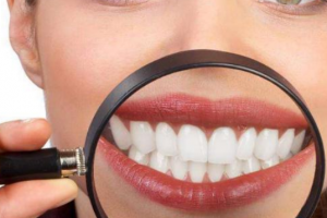 杭州美萊口腔醫(yī)院，口腔知識(shí)科普：牙齒美白多少錢(qián)一次？