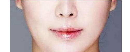 3分鐘，帶你了解醫(yī)美“黑話”