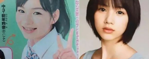 哪些人不適合做開眼角？