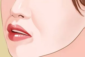 天生法令紋很深怎么辦？