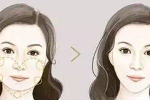 聽說許多明星都去打肉‘毒素’，有什么果？