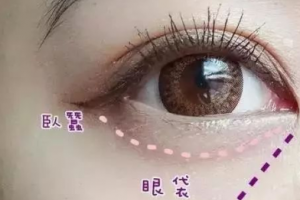 這3個(gè)溝不解決，永遠(yuǎn)顯老！