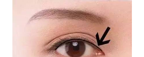 美瞳線這么美，你一定要做！