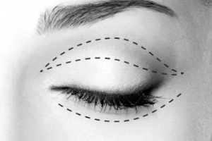 廣州曙光醫(yī)學(xué)美容醫(yī)院實力附2019年價格表