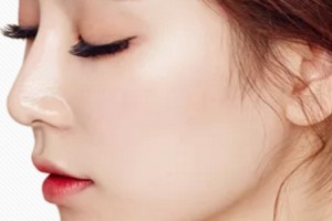 北京鼻部手術(shù)大概需要多少錢   鼻部手術(shù)價格貴不貴