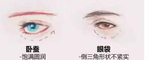 玻尿酸注射『臥蠶』，你需要嗎？