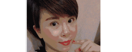 深圳藝星整形醫(yī)生常德成：她脂肪填充后，臉居然變小了？