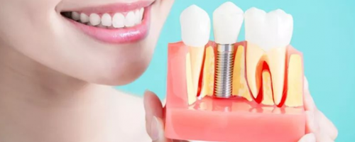 花了上萬塊的種植牙，怎么護(hù)理才能更耐用呢？