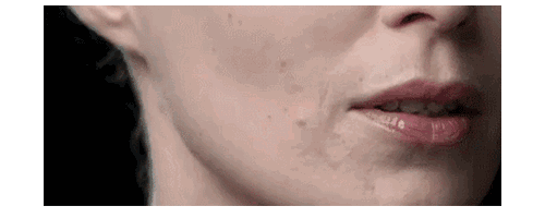 揭開(kāi)埋線提升秘密，幫你留住仙氣！