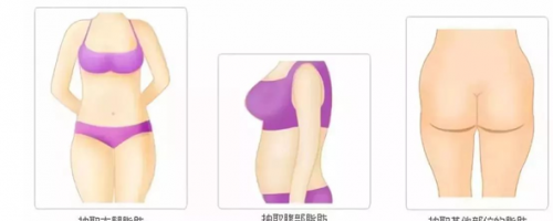 科普你真的了解自體脂肪填充么？