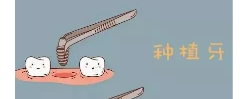 種植牙是在口腔里放一個“種子”讓牙萌出嗎？