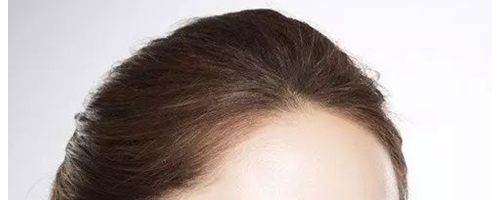 為什么祛斑越祛越多？