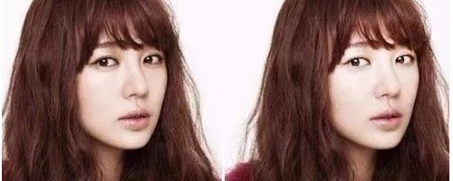 臥蠶與眼袋有什么區(qū)別？為什么臥蠶顯得可愛而眼袋會顯老呢