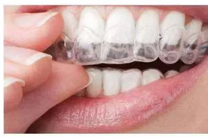 牙齒矯正后，臉會瘦嗎？臉型會產(chǎn)生哪些變化