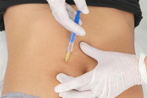 大連微美整形整形價(jià)格表及醫(yī)院介紹