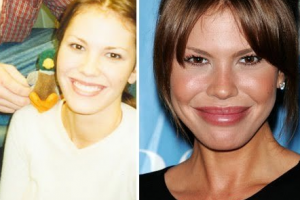 河南省現(xiàn)代醫(yī)學(xué)研究院中醫(yī)院毛發(fā)移植科室怎么樣附全新價(jià)格表(價(jià)目表)