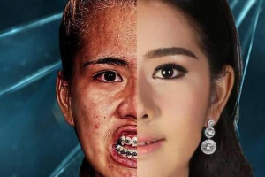 武漢科技大學附屬天佑醫(yī)院植發(fā)中心怎么樣附全新價格表(價目表)