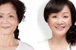 南寧雍禾植發(fā)怎么樣附全新價格表(價目表)